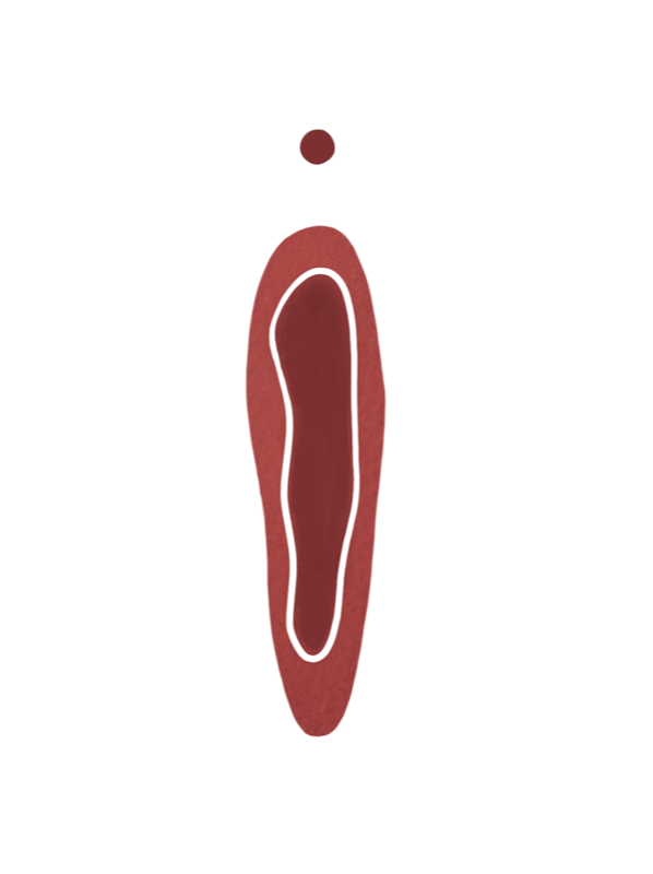 intaktes Hymen Illustration